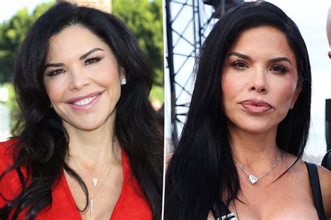 lauren sanchez surgery|Lauren Sanchez Plastic Surgery: Jeff Bezos Fiancee。